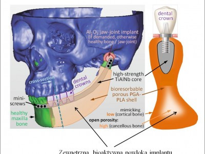 Bioactive hydrogel material for bone tissue regeneration